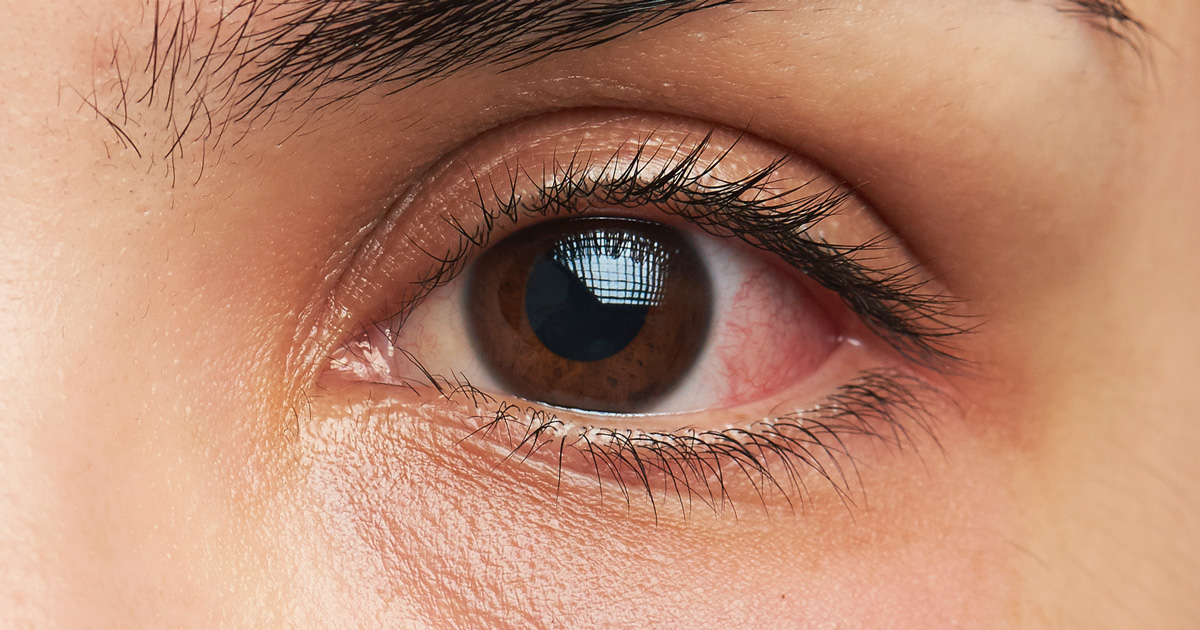 눈은 우리 신체중에서 가장 단순해보이지만 가장 복잡한 기관 중 하나다.