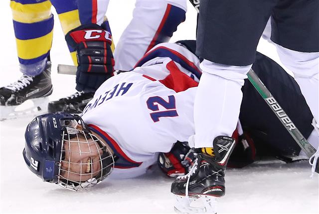 단일팀 김희원 ‘고통으로 일그러진 얼굴’