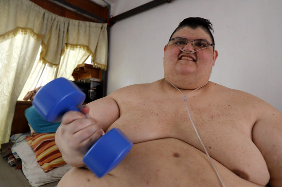 몸무게 595kg로 세계에서 가장 뚱뚱한 남성이었던 후안 페드로가 두 차례 수술과 치료를 받은 후 운동을 하며 감량에 도전하고 있다. 페드로는 250kg 가량을 감량한 상태다. AFP 연합뉴스