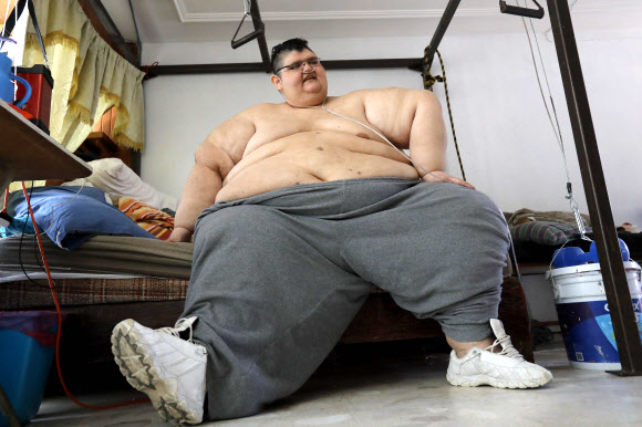 몸무게 595kg로 세계에서 가장 뚱뚱한 남성이었던 후안 페드로가 두 차례 수술과 치료를 받은 후 운동을 하며 감량에 도전하고 있다. 페드로는 250kg 가량을 감량한 상태다. AFP 연합뉴스