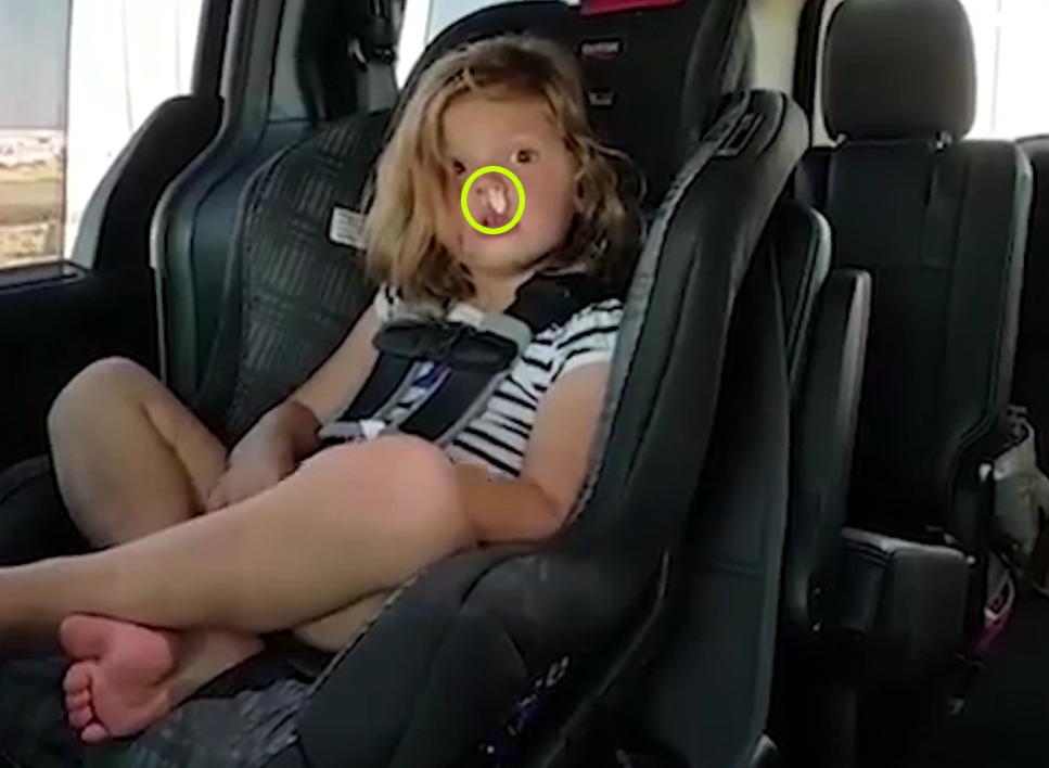 콧 속에 있던 아이의 씹던 껌이 재치기로 튀어 나오는 순간 모습(유튜브 영상 캡처)