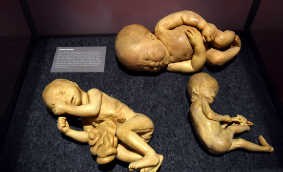 인간의 몸 전신이 12일(현지시간) 호주 시드니 무어 파크에서 ‘Real Bodies: The Exhibition’ arter가 전시되고 있다. EPA 연합뉴스