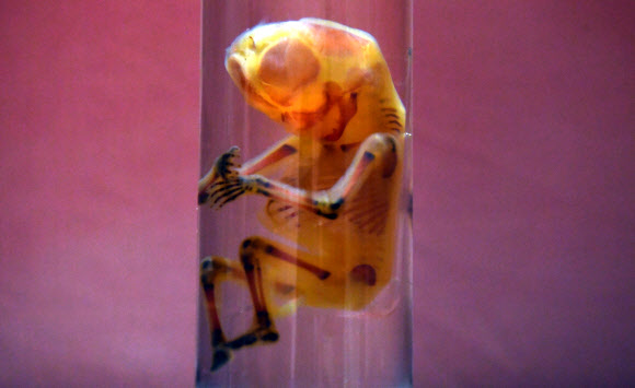 인간의 몸 전신이 12일(현지시간) 호주 시드니 무어 파크에서 ‘Real Bodies: The Exhibition’ arter가 전시되고 있다. EPA 연합뉴스