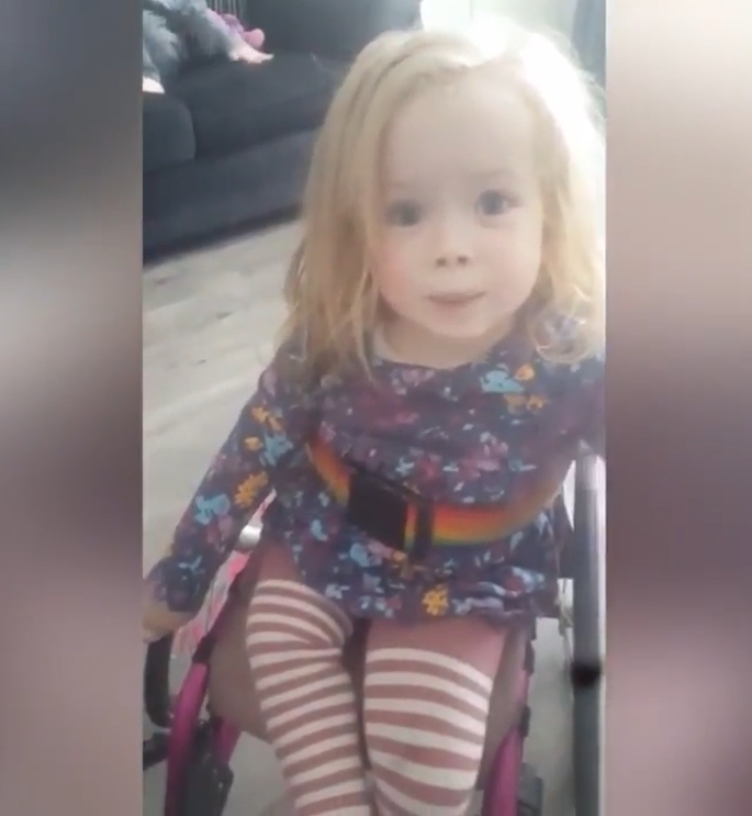 척추뼈 갈림증이란 병을 갖고 있는 2살 여아 앨리스(유튜브 영상 캡처)