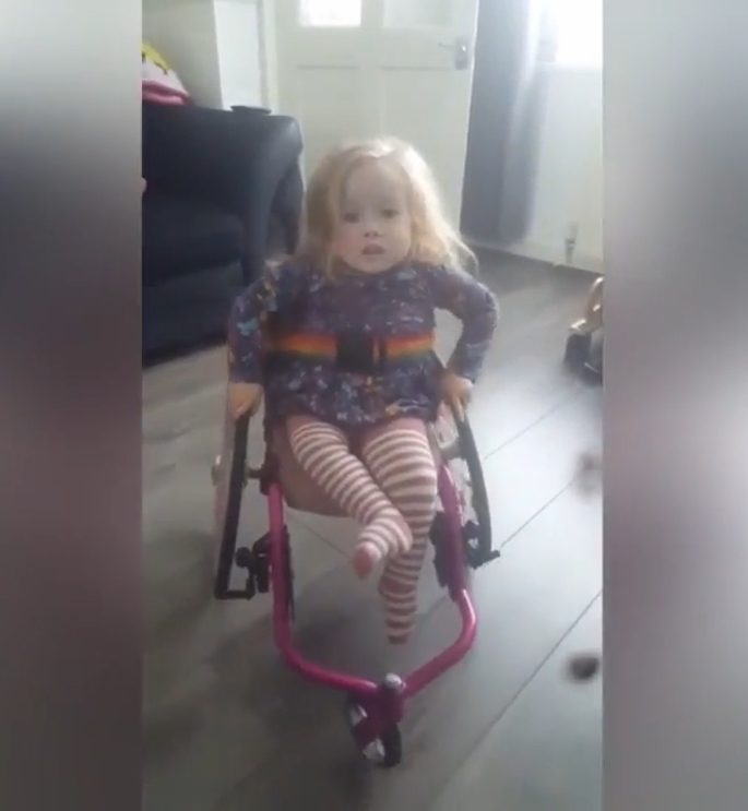 척추뼈 갈림증이란 병을 갖고 있는 2살 여아 앨리스(유튜브 영상 캡처)