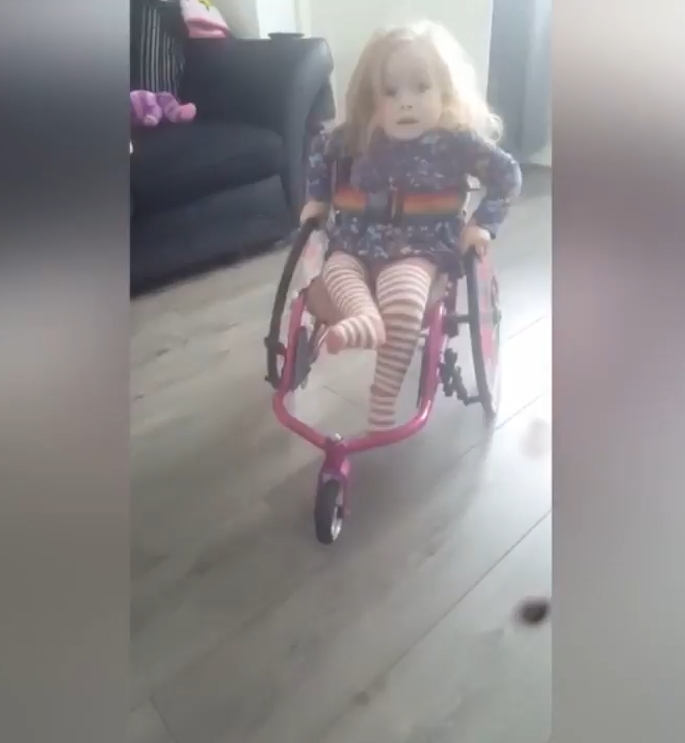 척추뼈 갈림증이란 병을 갖고 있는 2살 여아 앨리스(유튜브 영상 캡처)