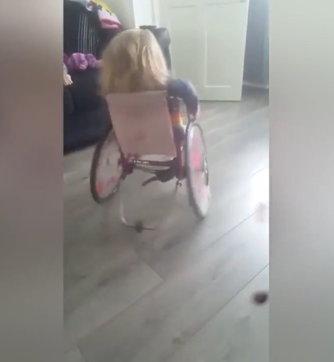 척추뼈 갈림증이란 병을 갖고 있는 2살 여아 앨리스(유튜브 영상 캡처)