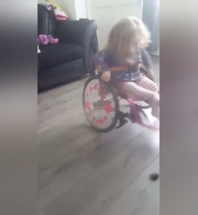 척추뼈 갈림증이란 병을 갖고 있는 2살 여아 앨리스(유튜브 영상 캡처)