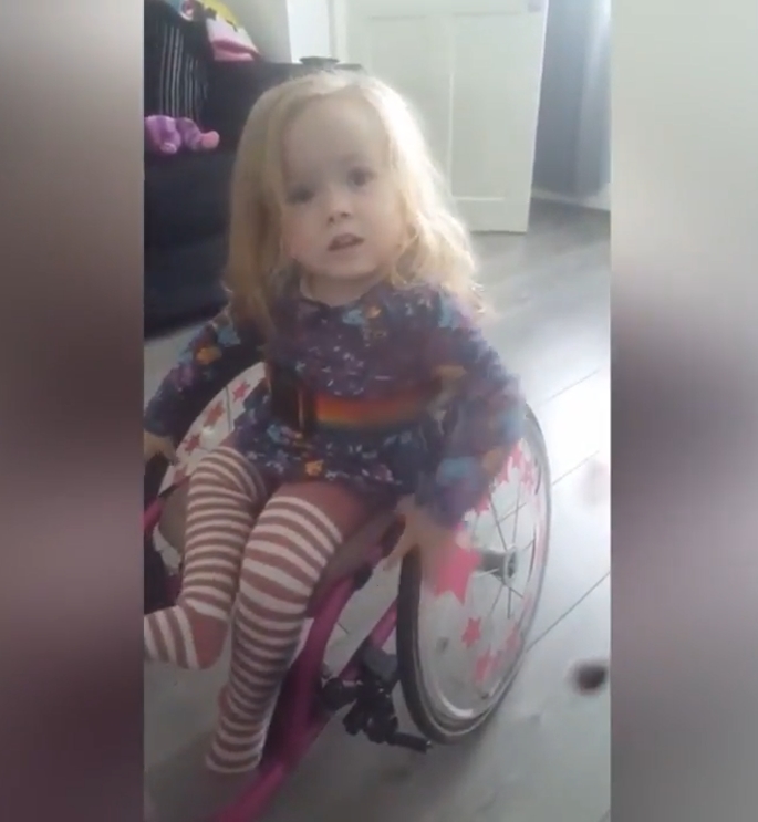 척추뼈 갈림증이란 병을 갖고 있는 2살 여아 앨리스(유튜브 영상 캡처)