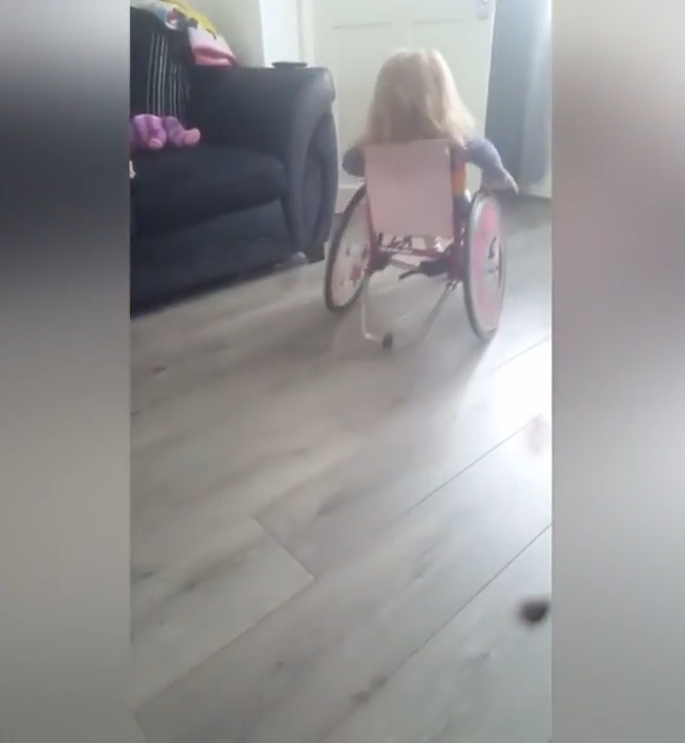 척추뼈 갈림증이란 병을 갖고 있는 2살 여아 앨리스(유튜브 영상 캡처)