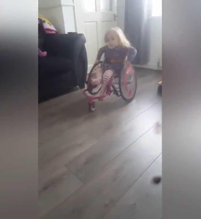 척추뼈 갈림증이란 병을 갖고 있는 2살 여아 앨리스(유튜브 영상 캡처)