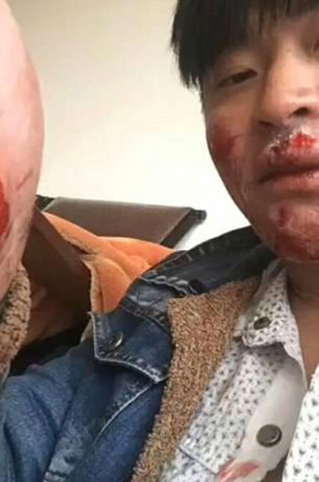 최근 중국 푸젠성 더화현 시티안 사찰에서 원숭이에게 짓궂은 장난을 건 남성이 봉변당하는 순간.