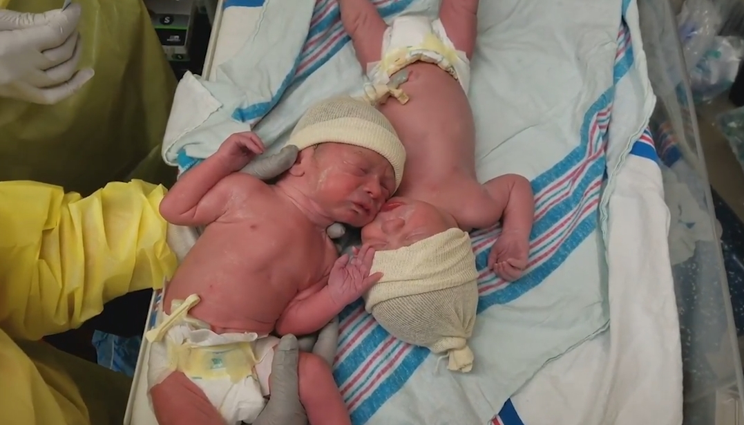 떼어 놓으면 울고, 붙여 놓으면 잠잠해지는 갓 태어난 쌍둥이 모습(유튜브 영상 캡처)