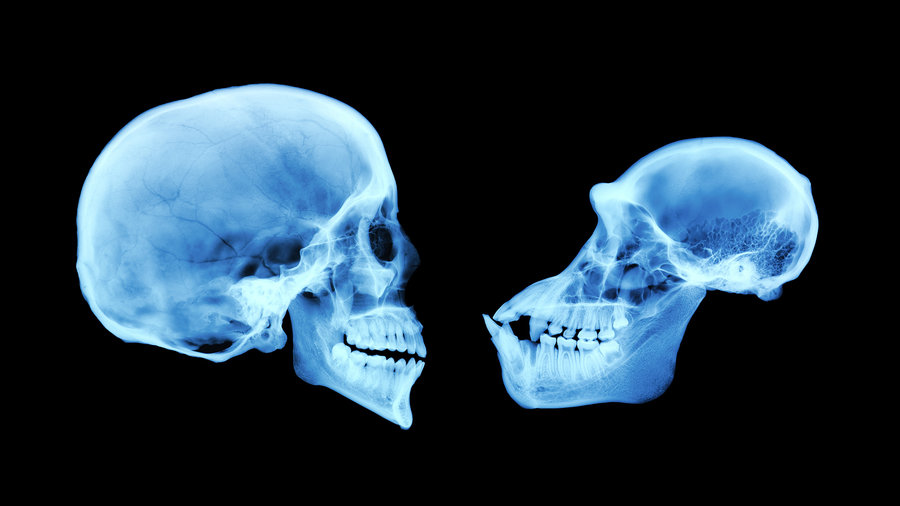 사람과 침팬지(오른쪽) 두개골을 찍은 X선 사진영상 NPR 제공