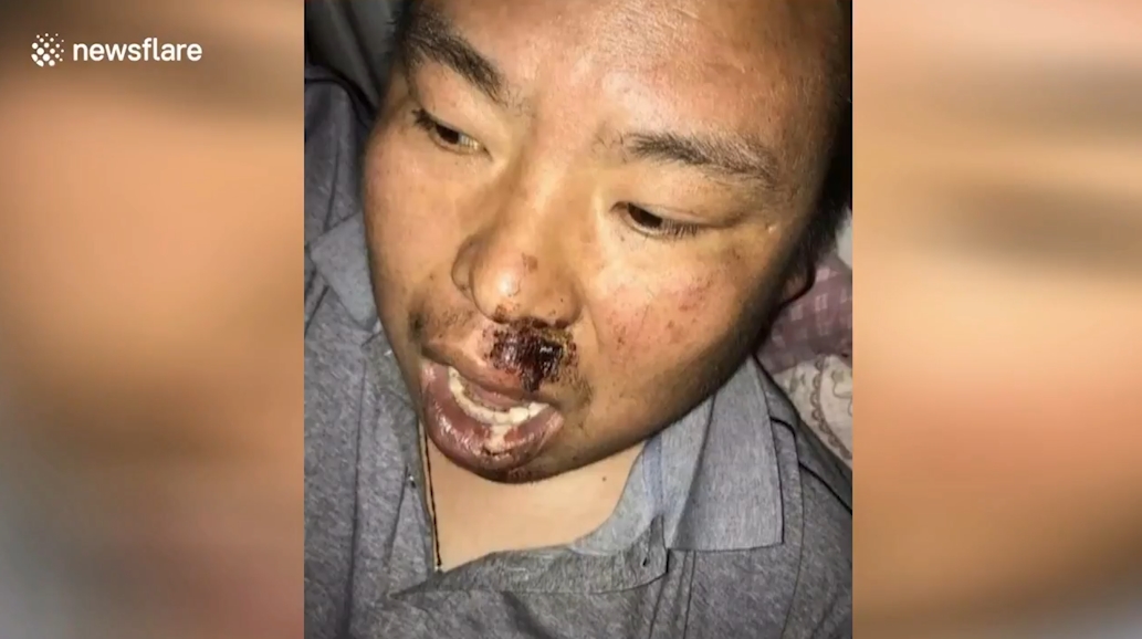 삼륜차 옆에 매달려 있는 아이를 구하기 위해 몸을 던져 막은 한 중국 남성의 영웅적 모습(유튜브 영상 캡처)