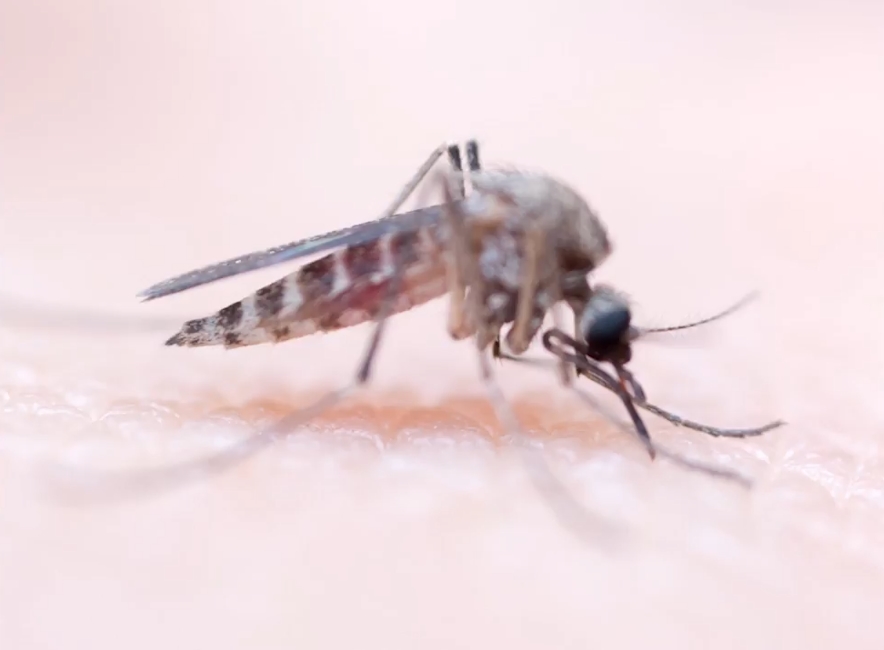 사람 살 표면에 붙어 있는 모기 한 마리가 사람 피를 흡입하는 놀랍고 생생한 모습