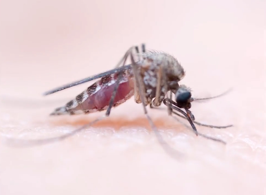 사람 살 표면에 붙어 있는 모기 한 마리가 사람 피를 흡입하는 놀랍고 생생한 모습