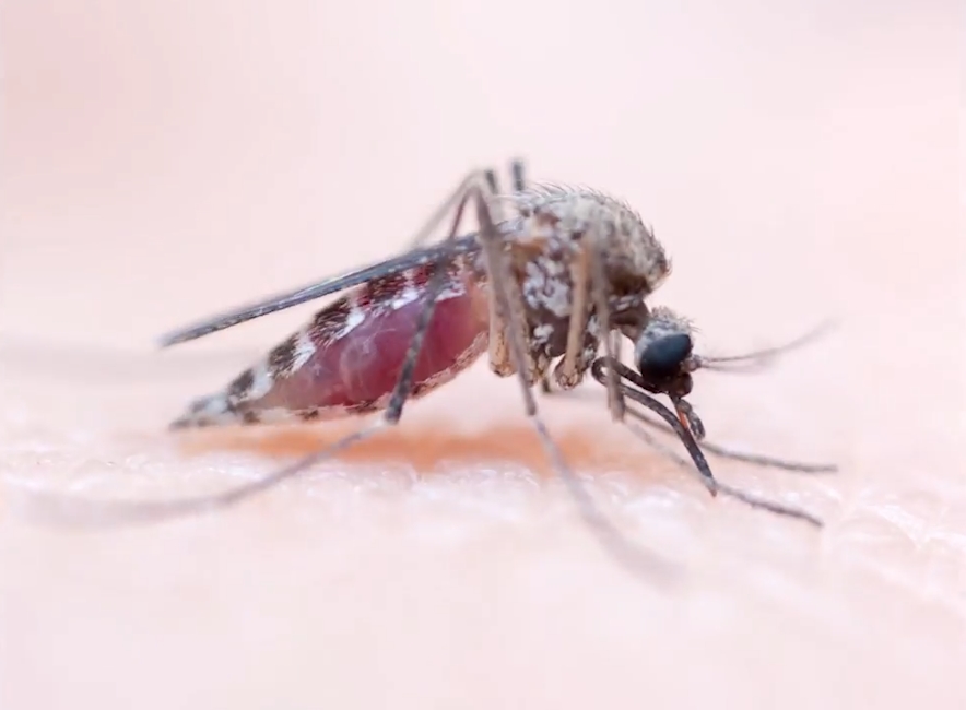 사람 살 표면에 붙어 있는 모기 한 마리가 사람 피를 흡입하는 놀랍고 생생한 모습