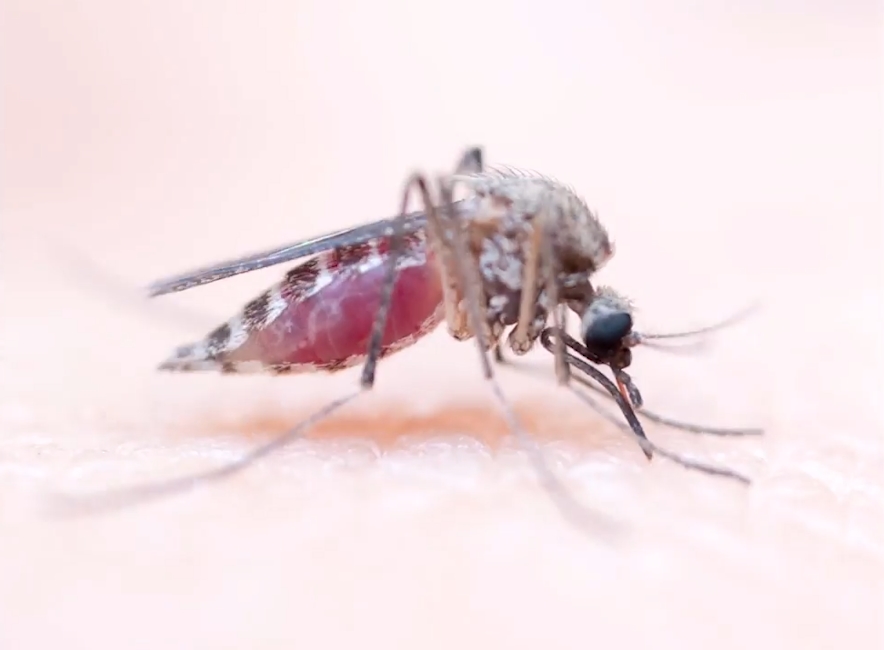 사람 살 표면에 붙어 있는 모기 한 마리가 사람 피를 흡입하는 놀랍고 생생한 모습