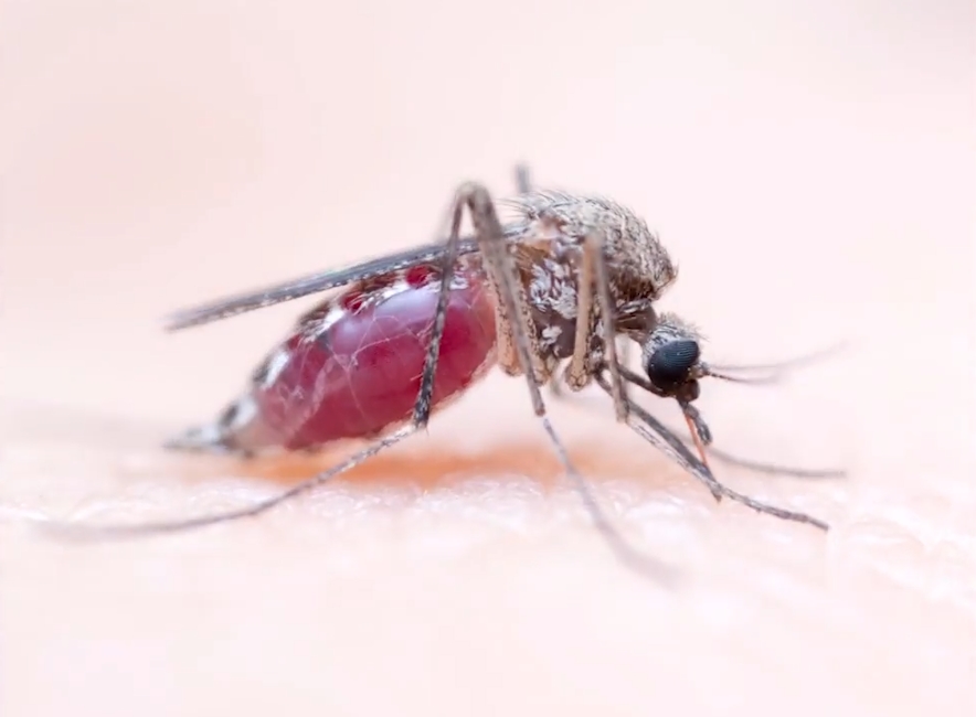 사람 살 표면에 붙어 있는 모기 한 마리가 사람 피를 흡입하는 놀랍고 생생한 모습