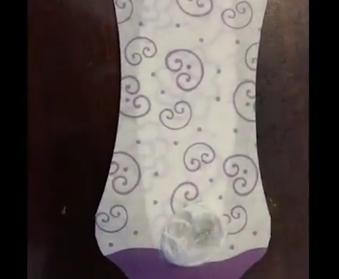 생리대 속 살아있는 거미의 끔찍한 모습(유튜브 영상 캡처)