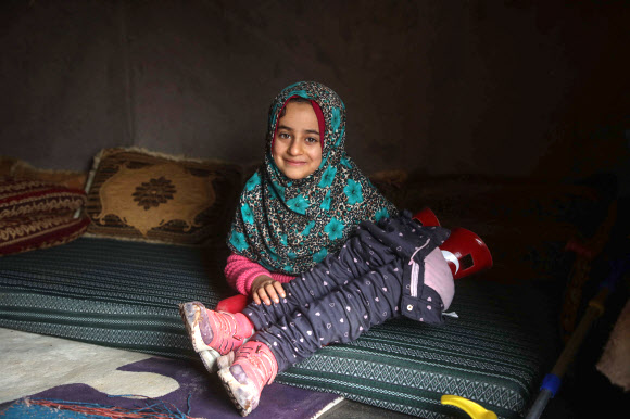 8세 시리아 소녀 마야 메르히가 9일(현지시간) 캠프에서 새 의족을 든 채 미소 짓고 있는 모습. 이들립 AFP 연합뉴스