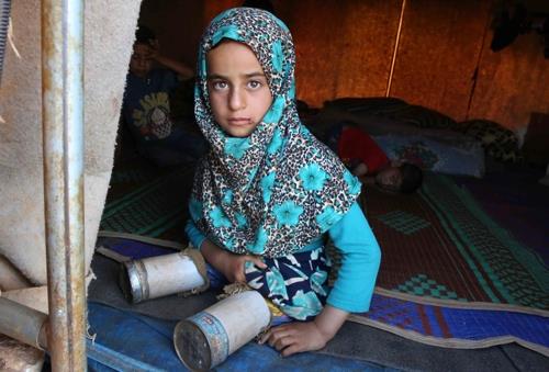 8세 시리아 소녀 마야 메르히가 지난 6월 이들립주 난민캠프에서 ‘깡통 의족’을 차고 앉아 있다. 이들립 AFP 연합뉴스