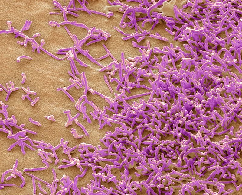 간암세포 이미지  간암은 여성보다 남성에게서 더 많이 나타나는 암이다. 최근 연구진이 성별에 따라 나타나는 암의 종류가 달라진다는 사실을 확인했다.<br>사이언스 라이브러리 제공