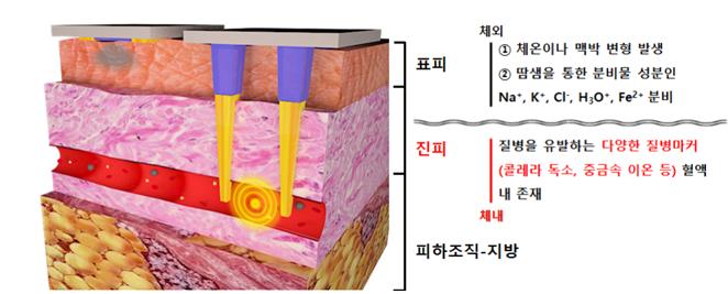 3차원 침습형 센서의 혈액 내 질병 원인 물질 감지 원리  한국연구재단 제공