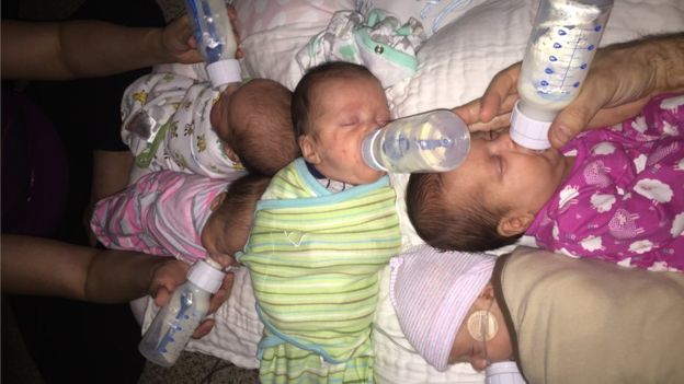 에이미와 채드 켐펠 부부가 고안해낸 다섯 쌍둥이 우유 동시에 먹이기 시스템.