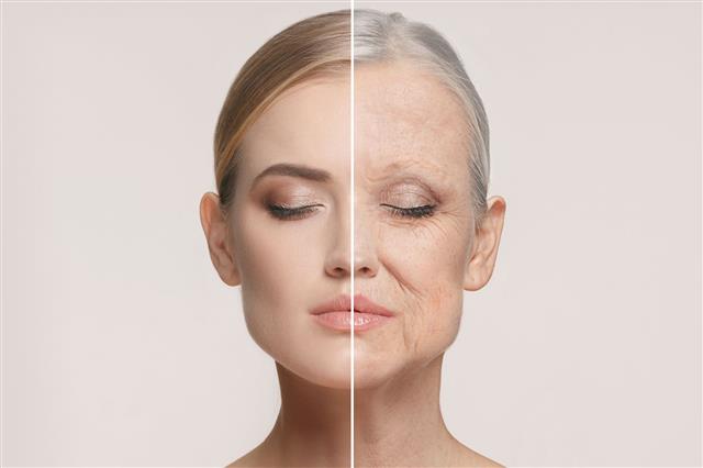 나이가 들어 나타나는 노화 현상은 피부에서 가장 먼저 눈에 띄게 나타난다. 노화된 피부는 두께가 얇아지고 약해지면서 주름이 나타나며 상처가 나게 될 경우 치유시간도 오래 걸리게 된다.  미국 하버드 공중보건대 제공