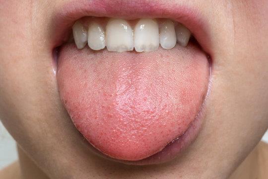 미국 연구진이 혀에도 냄새를 감지할 수 있는 수용체가 있다는 사실을 밝혀냈다.  사이언스데일리 제공