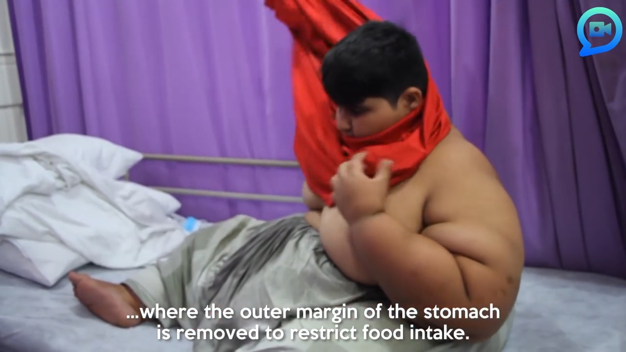 세상에서 가장 뚱뚱한 소년인 파키스탄 모하메드 아르브르(10)의 모습(유튜브 영상 캡처)