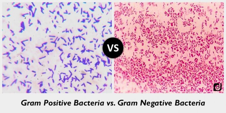 그람 양성균과 그람 음성균의 현미경 사진 위키피디아 제공