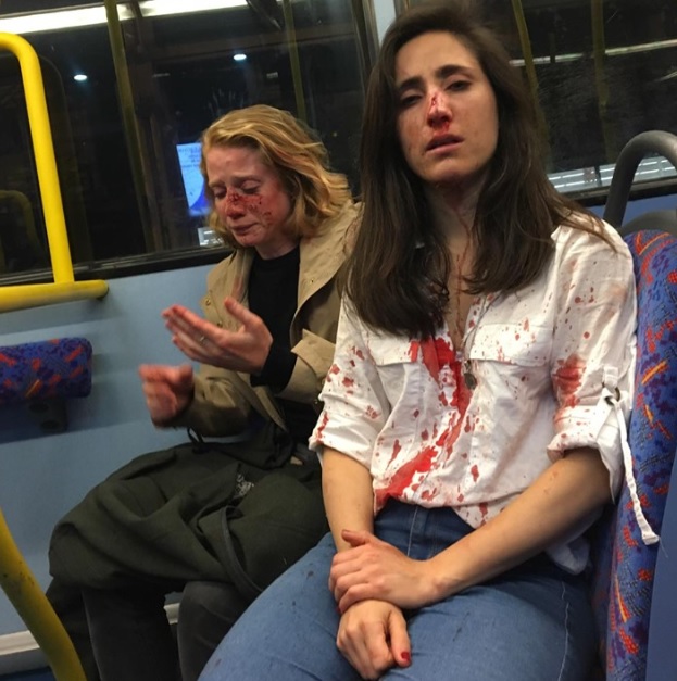 지난달 30일 영국 런던의 한 버스에서 성 소수자 혐오자들에게 집단폭행 당한 여성 동성애자 커플. 2019.6.9. 페이스북 캡처