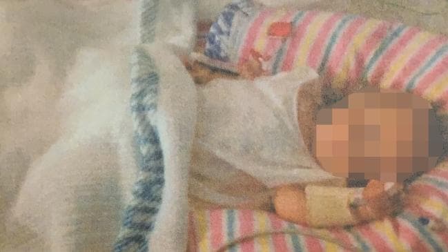 어머니의 지나친 채식 강요 때문에 생후 20개월 됐을 때 몸무게가 생후 3개월 또래 밖에 되지 않았던 딸아이의 발견 직후 모습. 호주 AP통신 자료사진 