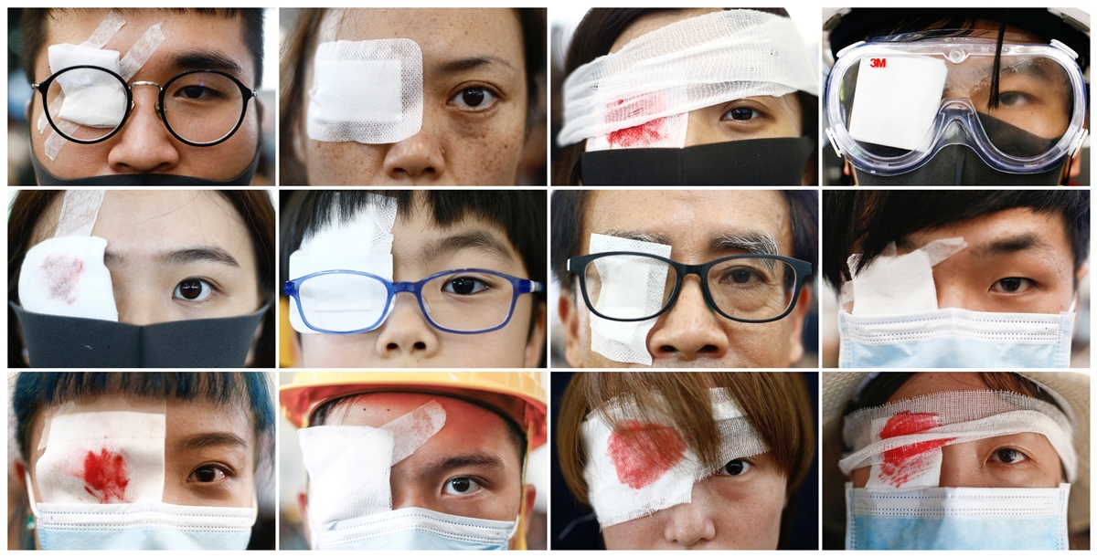 범죄인 인도 법안(송환법)에 반대하는 홍콩 시위대가 경찰의 무력 진압으로 실명 위기에 처한 여성의 이야기에 분노해 항의의 뜻으로 눈에 붕대를 감고 홍콩국제공항 점거 시위를 벌였다. 2019.8.12  로이터 연합뉴스