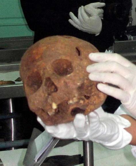 개구리소년 유골 확인작업