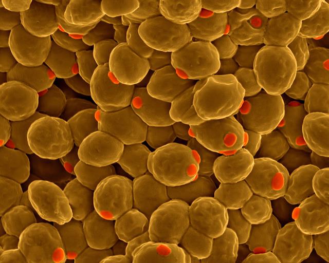 이스트, 누룩 등으로 불리는 효모균은 1500여종이 존재하고 있는 것으로 알려져 있으며 빵과 술을 만들 때 없어서는 안 되는 미생물이다. 효모균을 현미경으로 관찰한 모습.  네이처 제공