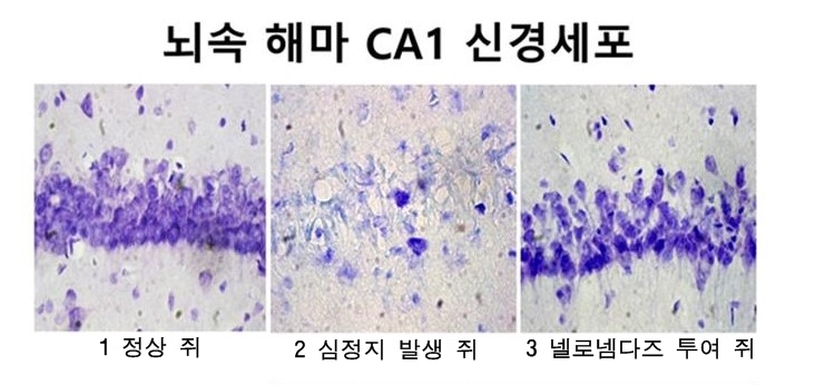 (1)정상 쥐의 뇌 해마 CA1 신경세포  (2)심정지후 3일째 되는 쥐. 해마의 CA1 신경세포가 사멸한다.  (3)심정지후 24시간 이내에 ‘넬로넴다즈’를 투여한 쥐. 해마 CA1 신경세포 사멸이 줄어든다.
