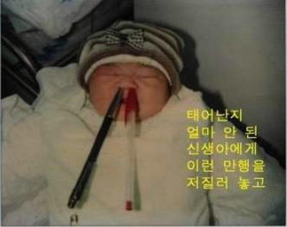 신생아를 학대하는 사진 출처:서울신문 포토라이브러리