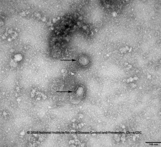 중국 우한 폐렴 코로나바이러스 전자현미경 사진.  중국 질병예방통제센터(CDC)=질병관리본부