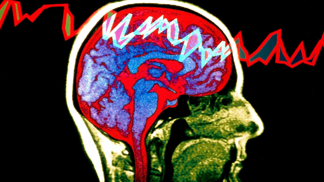 뇌전증 환자의 뇌 속 변화 실시간 관찰기술 개발
