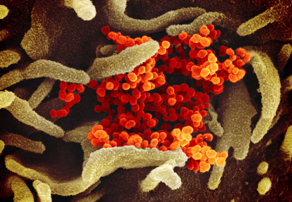 미국 연구기관이 자국 환자에게서 추출해 내놓은 코로나19 바이러스의 모습. AP통신