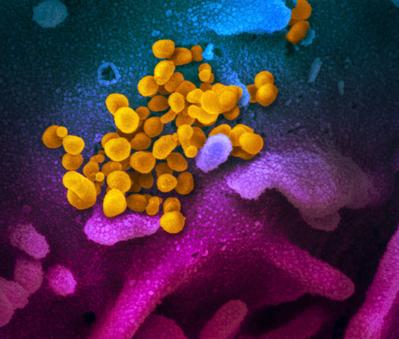 신종 코로나바이러스 전자현미경 이미지