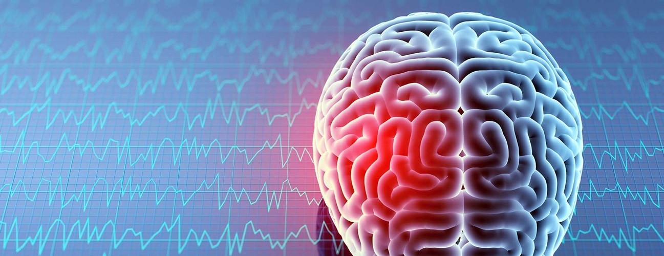 뇌손상 환자 예후 예측하는 기술 개발