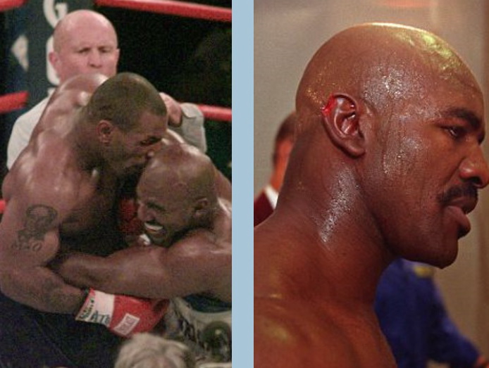 1997년 6월 28일 미국 라스베이거스에서 열린 WBA 헤비급 타이틀매치 3라운드에서 마이크 타이슨이 에반더 홀리필드의 귀를 물어뜯고 있다. 오른쪽은 귀가 물어뜯기니 홀리필드의 모습. [서울신문 DB]