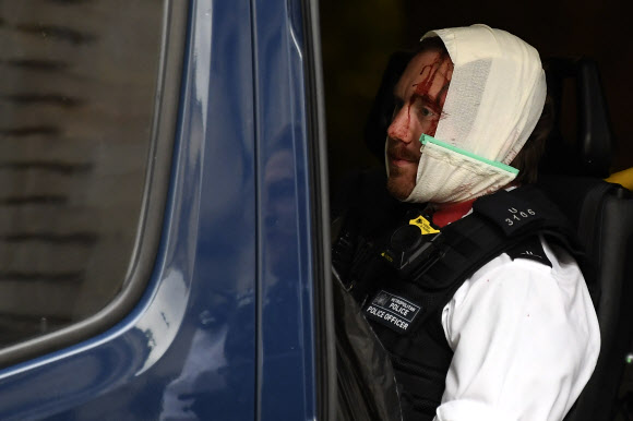 7일(현지시간) 영국 런던에서 미국 백인 경찰의 과잉 진압으로 흑인 조지 플로이드가 사망한 사건에 항의하는 시위대와 충돌로 부상한 한 경찰관이 머리에 붕대를 감은 채 구급차에 앉아 있다.  AP 연합뉴스