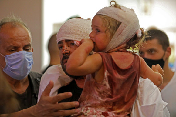 4일(현지시간) 레바논 베이루트에서 발생한 초대형 폭발 사고로 다친 시민들이 인근 병원에서 치료를 받고 있다. 머리에 붕대를 감싼 여자 아이에게서 폭발 당시의 처참한 모습이 엿보인다.  베이루트 AFP 연합뉴스