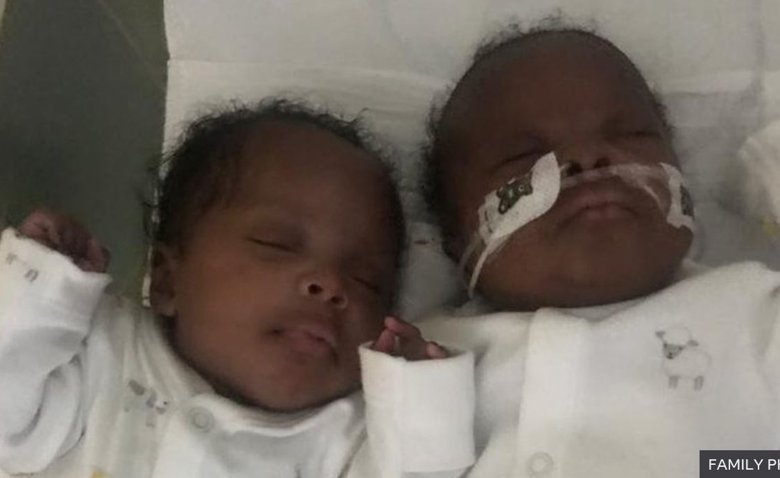 임신 26주 만에 제왕절개 수술로 세상에 나온 쌍둥이 남매 소치카(왼쪽)와 오시나치. 엄마는 열엿새 뒤에나 깨어나 병원 직원들이 보여준 사진을 보고서 그랬단다. “인간 같지도 않아 보이네요.” 　페펙투얼 우케 가족 제공 　영국 BBC 홈페이지 캡처 